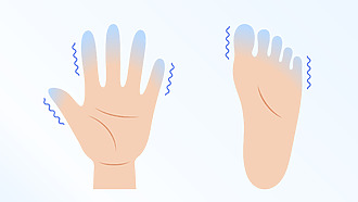 Příznaky polyneuropatie nohou a rukou:
 slabost a snížená citlivost