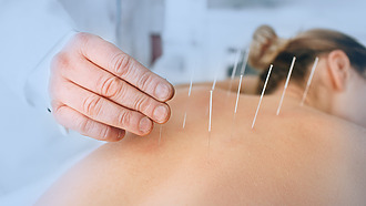 Acupuncture - alternative pain treatment after surgery