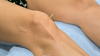 Arthritis of the knee alternative treatment