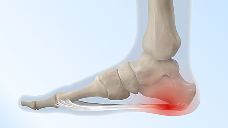 What to do if your feet hurt?