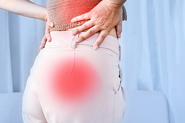 Sciatica - buttock pain