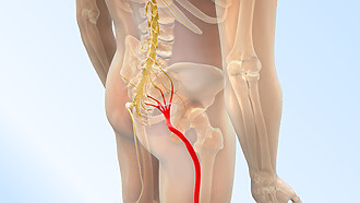 Sciatic nerve compression can cause numbness in the lower limbs