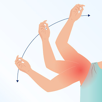 Pain and limited mobility in frozen shoulder