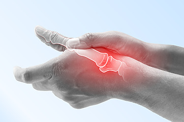 Patients have swollen joints in the fingers of the hand and limited mobility